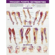 Trigger Points Extremities 594mm x 420mm