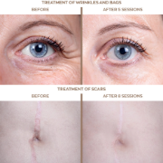 Picture of Globus Tecar Beauty Elite