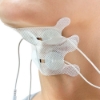 Synergy Dysphagia Snap Electrodes