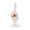 Knee Model - Life Size Knee Joint