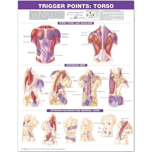 Trigger Points Torso 594mm x 420mm